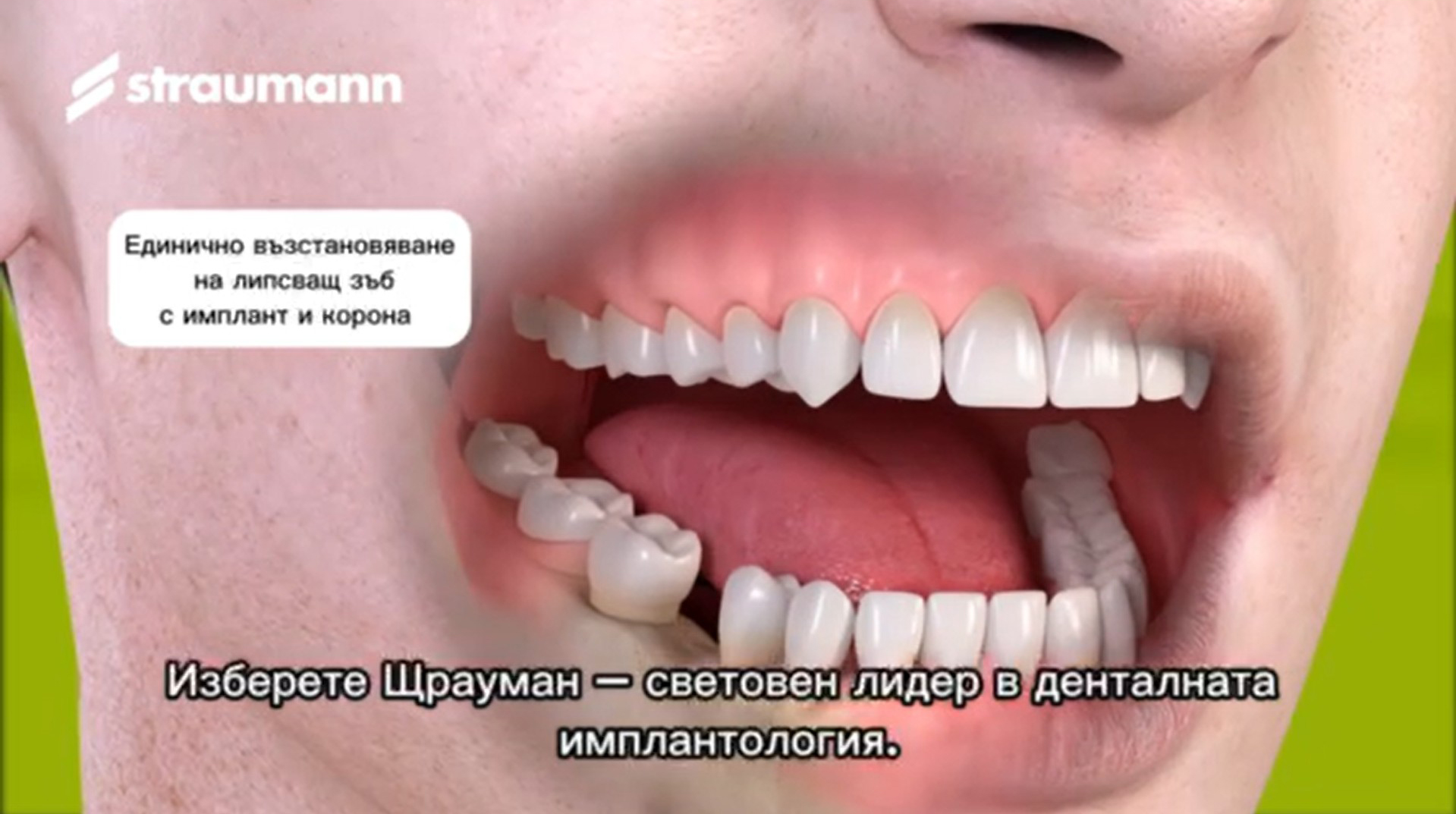 Video thumb